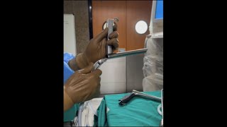 MLS microlaryngoscopy procedure [upl. by Romeon]