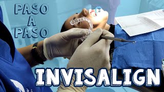 Ortodoncia invisible invisalign│Paso a Paso [upl. by Fulbright]