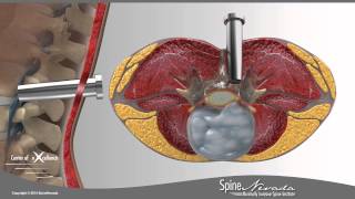 Surgical Anticipation and Instrument Passing [upl. by Cleon]