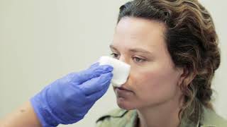 How to stop Nose Bleeding First aid at Home [upl. by Ytsirt]