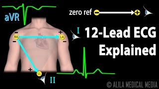 12 Lead ECG Explained Animation [upl. by Ahsitneuq]