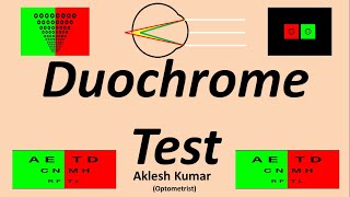 Duochrome Test  Red Green Test  FRIEND Test [upl. by Caines]