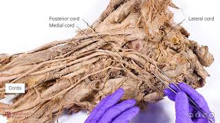 Brachial Plexus and Axillary Artery [upl. by Naples]