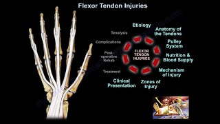 Flexor Tendon Injuries  Everything You Need To Know  Dr Nabil Ebraheim [upl. by Sseb]