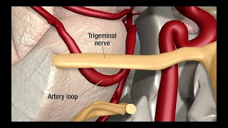 Microsurgery and Reconstruction at Duke [upl. by Tavia]