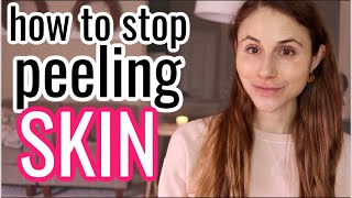 How to STOP PEELING SKIN Dr Dray [upl. by Chelsey]