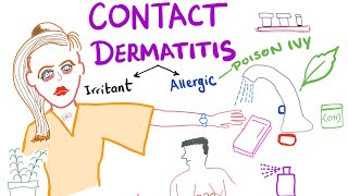 Contact Dermatitis [upl. by Smitty]