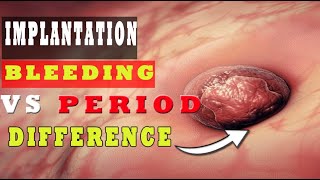 Implantation Bleeding Vs Period – How to Know the Difference 🩸🩸 [upl. by Alair]