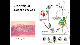 Balantidium Coli Class Ciliate Parasitology [upl. by Monreal]