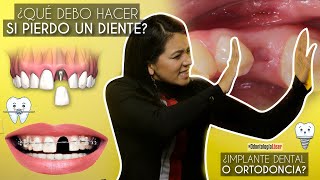 ¿Qué debo hacer si pierdo un diente ¿Implante dental o ortodoncia  Odontología Láser [upl. by Alair]