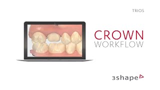 3Shape TRIOS  Crown Workflow [upl. by Roxanna]