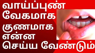 வாய் புண் வேகமாக குணமாக  vaai pun treatment in tamil  Mouth Ulcer Treatment [upl. by Zaria]