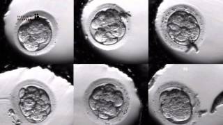 IVF PROCESS STEP BY STEP In Vitro Fertilisation Embryo cultivation [upl. by Anotal555]