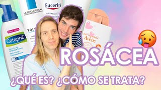 ¿Qué es la ROSACEA ¿Cómo se trata  Productos que recomiendo [upl. by Arola]