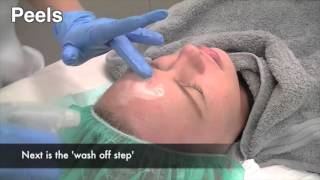 How to treat melasma pigmentation [upl. by Hgeilhsa]