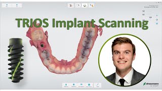 3shape TRIOS  Straumann Implant Scanning Workflow [upl. by Collie635]