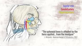 All About Orthodontic Headgear [upl. by Enaitsirhc]