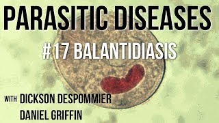 Parasitic Diseases Lectures 17 Balantidiasis [upl. by Bjork]