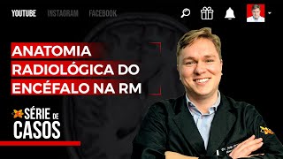 Anatomia Radiológica do Encéfalo na RM [upl. by Ulita]